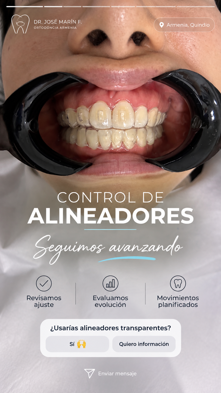 Control clínico de alineadores transparentes en Ortodoncia Armenia con el Dr. José Marín